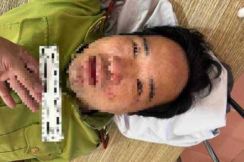 Trạm trưởng Kiểm lâm bị xe chở lâm sản trái phép đâm trọng thương
