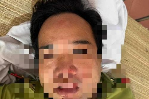 Trạm trưởng kiểm lâm bị xe tải đâm trọng thương