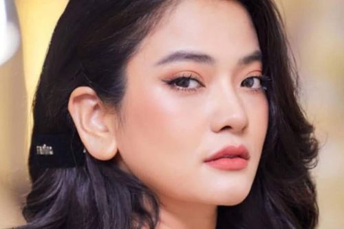 Diễn viên Thúy Hằng gặp tai nạn kinh hoàng phải khâu 78 mũi trên mặt