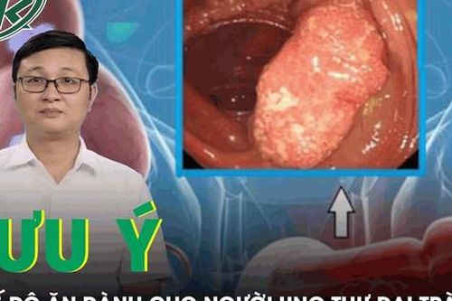 Người bị ung thư đại tràng cần lưu ý gì trong chế độ ăn?