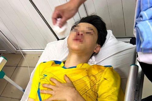 Trên đường đi thi lớp 10, nam sinh va chạm với xe ô tô phải bỏ thi môn cuối cùng