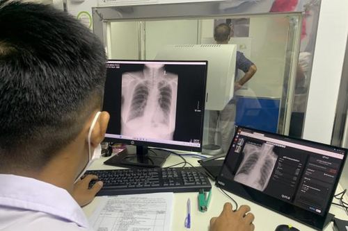 Tầm soát bệnh lao cho hơn 400 người