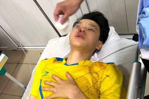Gặp tai nạn trên đường, một thí sinh Nghệ An lỡ thi môn cuối