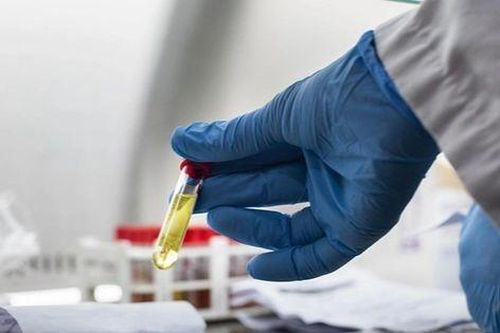 WHO thông tin về ca tử vong đầu tiên do virus cúm A/H5N2