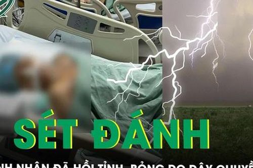 Người phụ nữ bị sét đánh ở Hà Nội đã hồi tỉnh, cổ bỏng do đeo dây chuyền bằng vàng