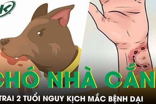 Bị chó nhà cắn vào cổ, bé trai 2 tuổi nguy kịch vì mắc bệnh dại
