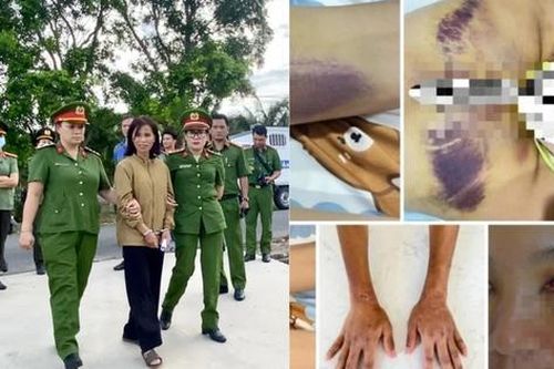 Người phụ nữ bị gia đình chồng cũ bạo hành dã man vì coi là 'mầm họa'