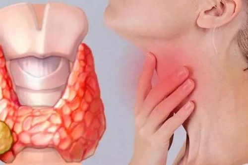 9 câu hỏi thường gặp về bệnh ung thư tuyến giáp