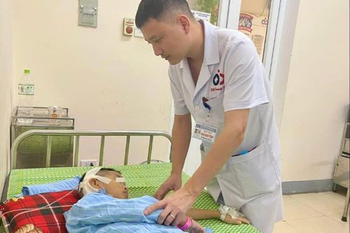 Chủ quan với bệnh viêm tai giữa, trẻ 2 tuổi gặp biến chứng áp xe não