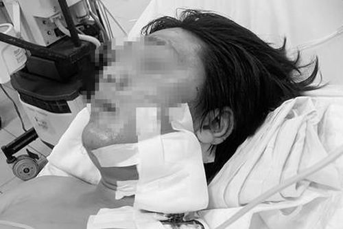 Cứu kịp thời thanh niên bị dao đâm vào cổ nguy kịch tính mạng