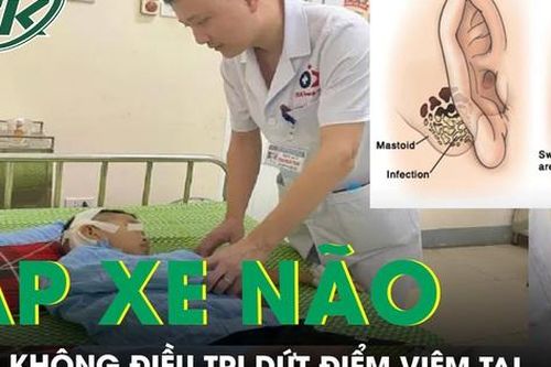 Nguy kịch vì không điều trị dứt điểm viêm tai dẫn tới biến chứng áp xe não