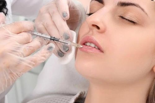 Tiêm filler có an toàn không, bao lâu mới tan hết?