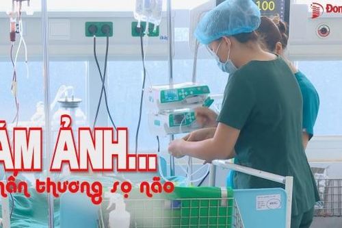 Ám ảnh… chấn thương sọ não