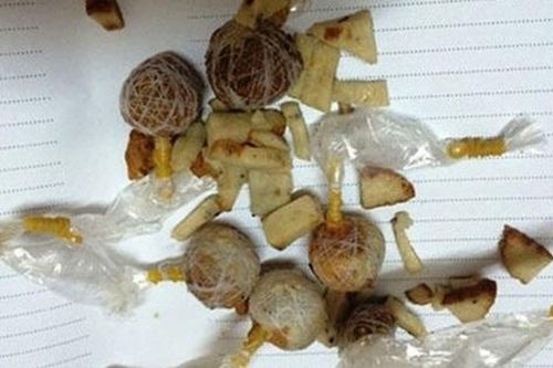 Ăn nhầm bả chó, bé 22 tháng tuổi nguy kịch