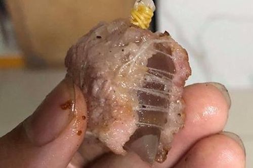 Bé 22 tháng tuổi ở Đắk Nông nguy kịch vì ăn nhầm phải bả chó