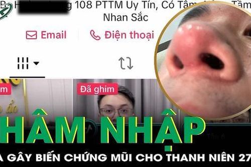 Thâm nhập spa gây biến chứng mũi cho nam thanh niên 27 tuổi