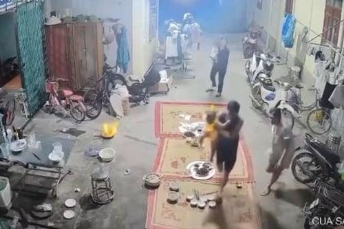 Bé gái bị bỏng khi nướng mực: Bác sĩ cảnh báo sai lầm nhiều nhà mắc phải trong mùa Euro