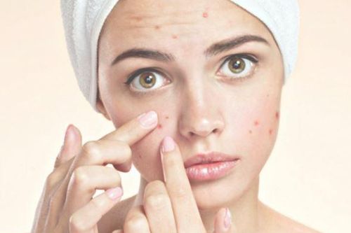Cách trị mụn cấp tốc và hiệu quả nhất chỉ trong một ngày