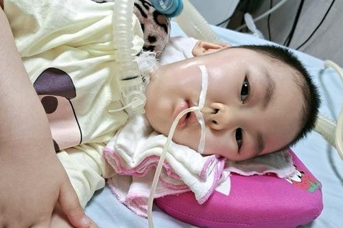 MS 933: Xót xa hoàn cảnh bé gái suốt hơn 4 năm sống thực vật vì bệnh tật
