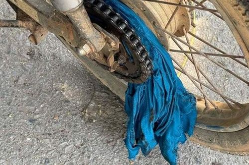 Ngã gãy tay do sai lầm khi mặc áo chống nắng