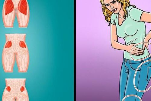 Cách gì ngăn ngừa hội chứng cơ mông chết do lười vận động?