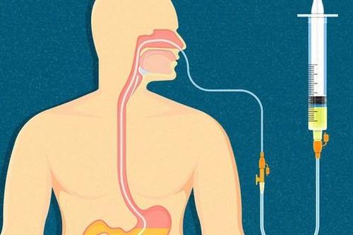 Chăm sóc dinh dưỡng cho người bị uốn ván