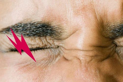 Chớp mắt bị đau là do đâu? Cẩn thận bị mất thị lực vĩnh viễn!