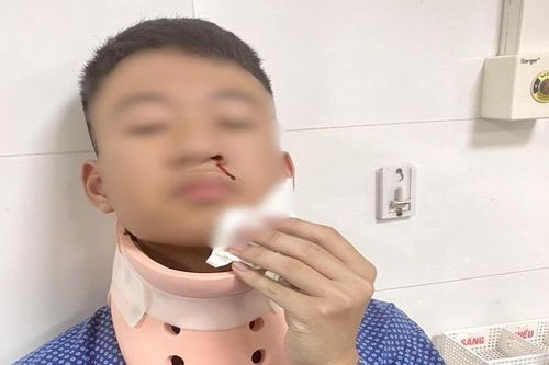Vụ bé trai mồ côi cha bị tổn hại 12% sức khỏe: Cần một bản án nghiêm minh, bảo vệ quyền trẻ em