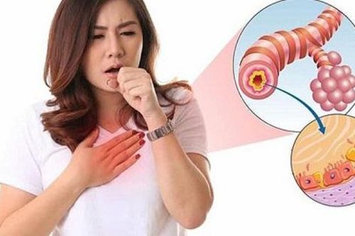 Những câu hỏi thường gặp về bệnh viêm phế quản