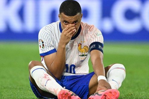Tình trạng của Mbappe sau sự cố vỡ mũi