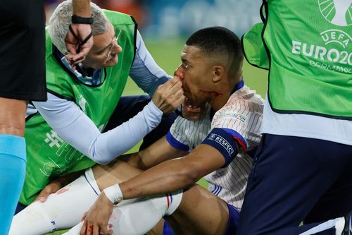 Gặp chấn thương mũi, Kylian Mbappé để ngỏ khả năng ra sân trận tiếp theo