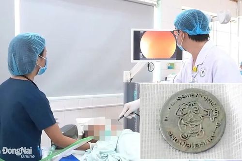 Cấp cứu bé trai 3 tuổi nuốt phải đồng xu trong lúc chơi đùa