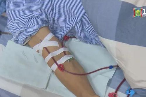 Lọc máu tuyến huyện giảm gánh nặng cho người bệnh