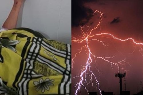 Nam thanh niên bị sét đánh ngất ngay trong phòng ngủ, bác sĩ đưa ra khuyến cáo