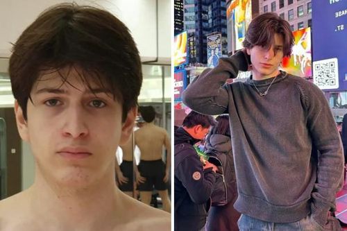 Trai gen Z đua nhau chi 'tiền tấn' phẫu thuật thẩm mỹ để giống ngôi sao