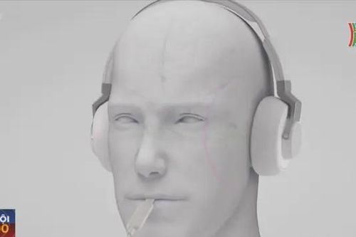 Mỹ phê duyệt thiết bị điều trị chứng ù tai