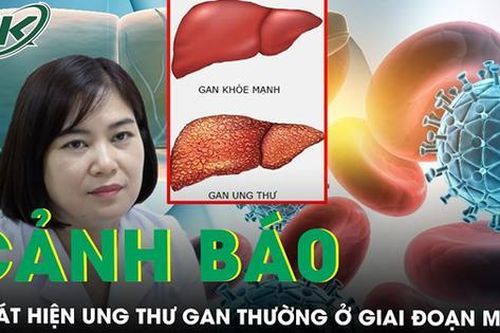 Chuyên gia cảnh báo, ung thư gan thường phát hiện ở giai đoạn muộn