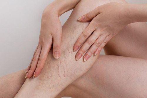Căn bệnh rình rập dân văn phòng, nghĩ đơn giản nhưng nguy cơ khó lường
