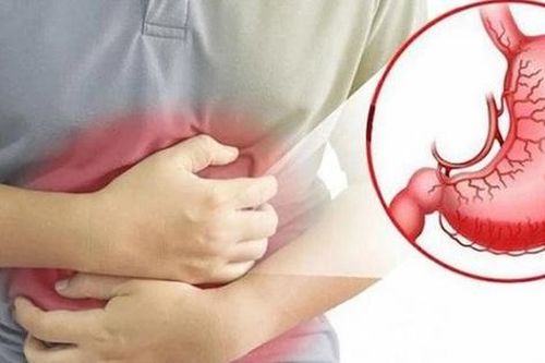 Người đàn ông 38 tuổi ở Phú Thọ thủng dạ dày vì thói quen chữa bệnh xương khớp nhiều người Việt mắc phải