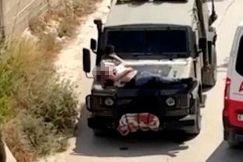 Binh sĩ trói người bị thương trên xe Jeep rồi chở đi, quân đội Israel lên tiếng