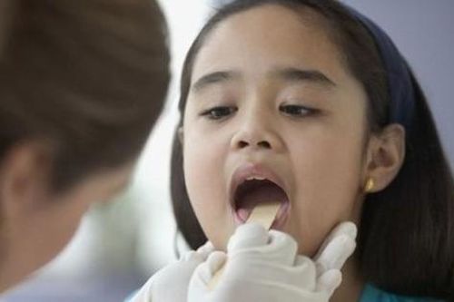 9 câu hỏi thường gặp liên quan đến bệnh viêm amidan