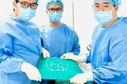 Phát hiện 200 viên sỏi trong khớp vai, bác sĩ cảnh báo căn bệnh nguy hiểm
