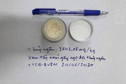 Cô gái nguy kịch vì dùng 5 hộp kem chống nám chứa hàm lượng thủy ngân vượt ngưỡng 4.000 lần