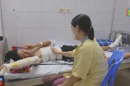 Cảnh báo trẻ em bị bỏng, điện giật trong dịp hè