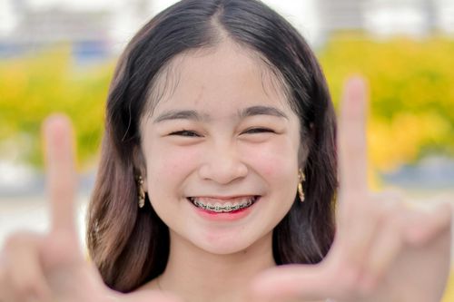 'Ma trận' giá niềng răng