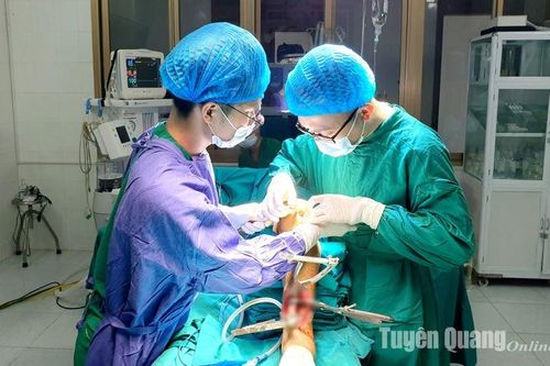 Trung tâm Y tế huyện Chiêm Hóa triển khai thành công kỹ thuật đóng đinh nội tủy xương chày