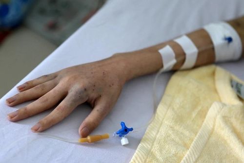 Những thay đổi trên cơ thể có thể là dấu hiệu của ung thư
