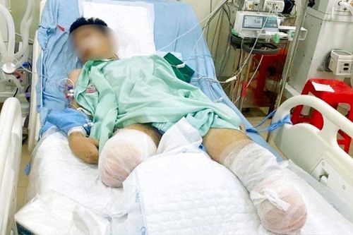 Nam sinh được đặc cách tốt nghiệp THPT vì tai nạn giao thông mất đôi chân