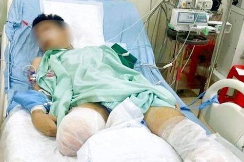 Vĩnh Phúc: Nam sinh bị tàu hỏa cán được xét đặc cách tốt nghiệp THPT