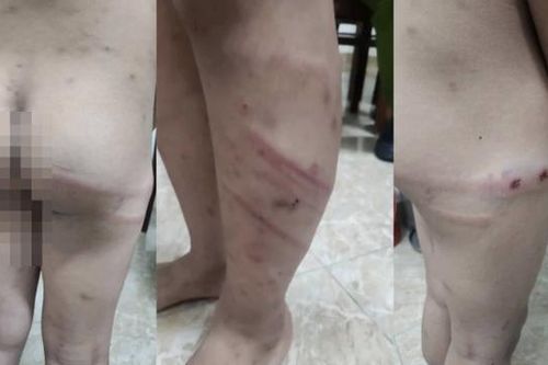 Mẹ ruột và bạn trai bạo hành con trai 11 tuổi